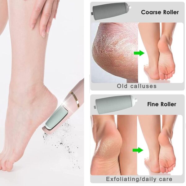 Electric Foot Grinder Callus Remover Foot Scrubber - Image 3