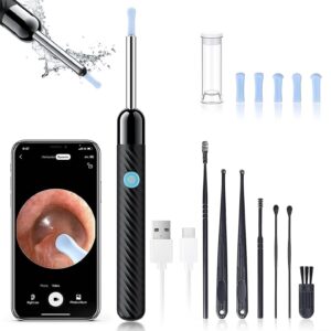 Wireless Camera Earwax Removal Ear Cleaner